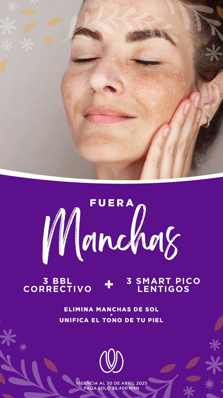 ¡Fuera Manchas!